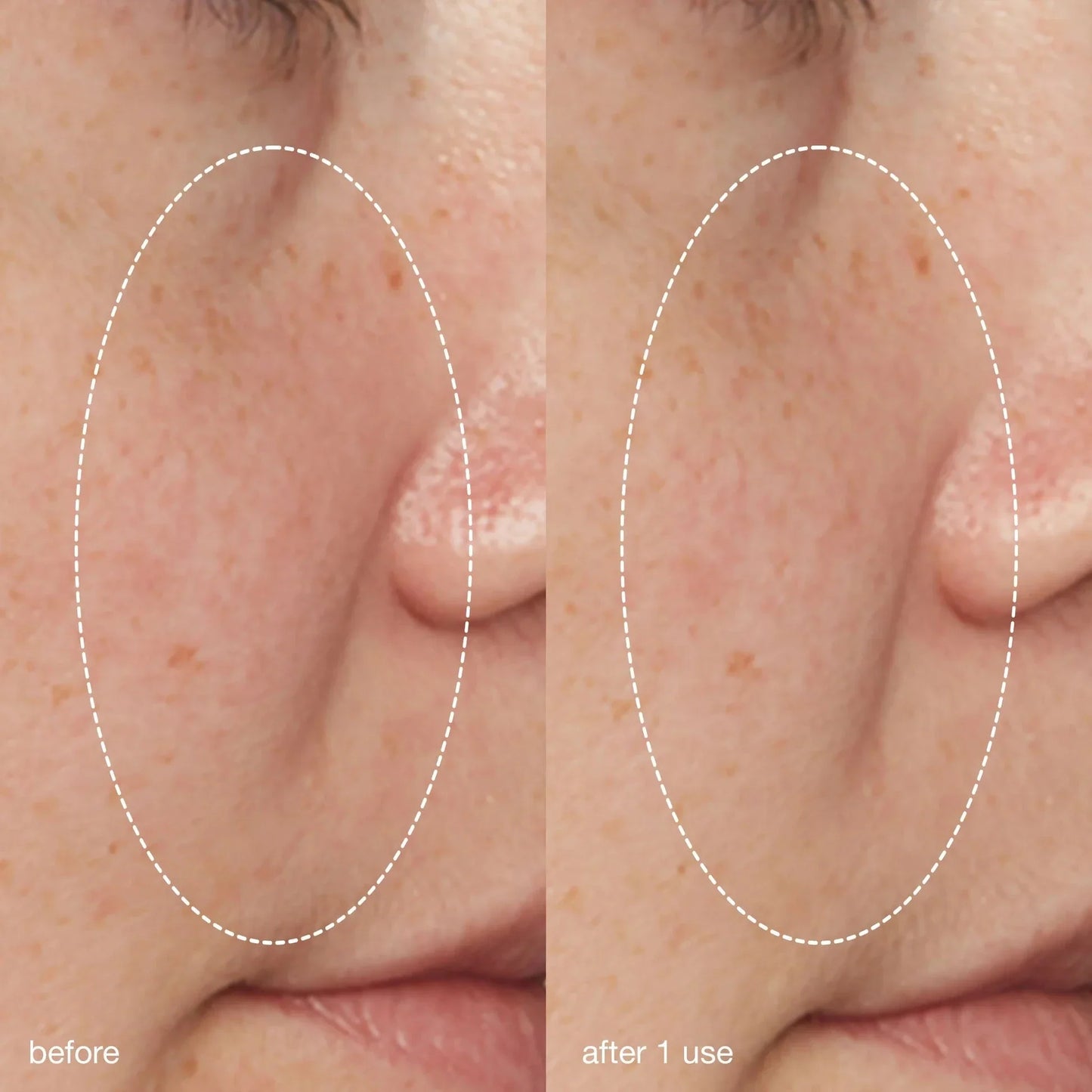 liquid peelfoliant