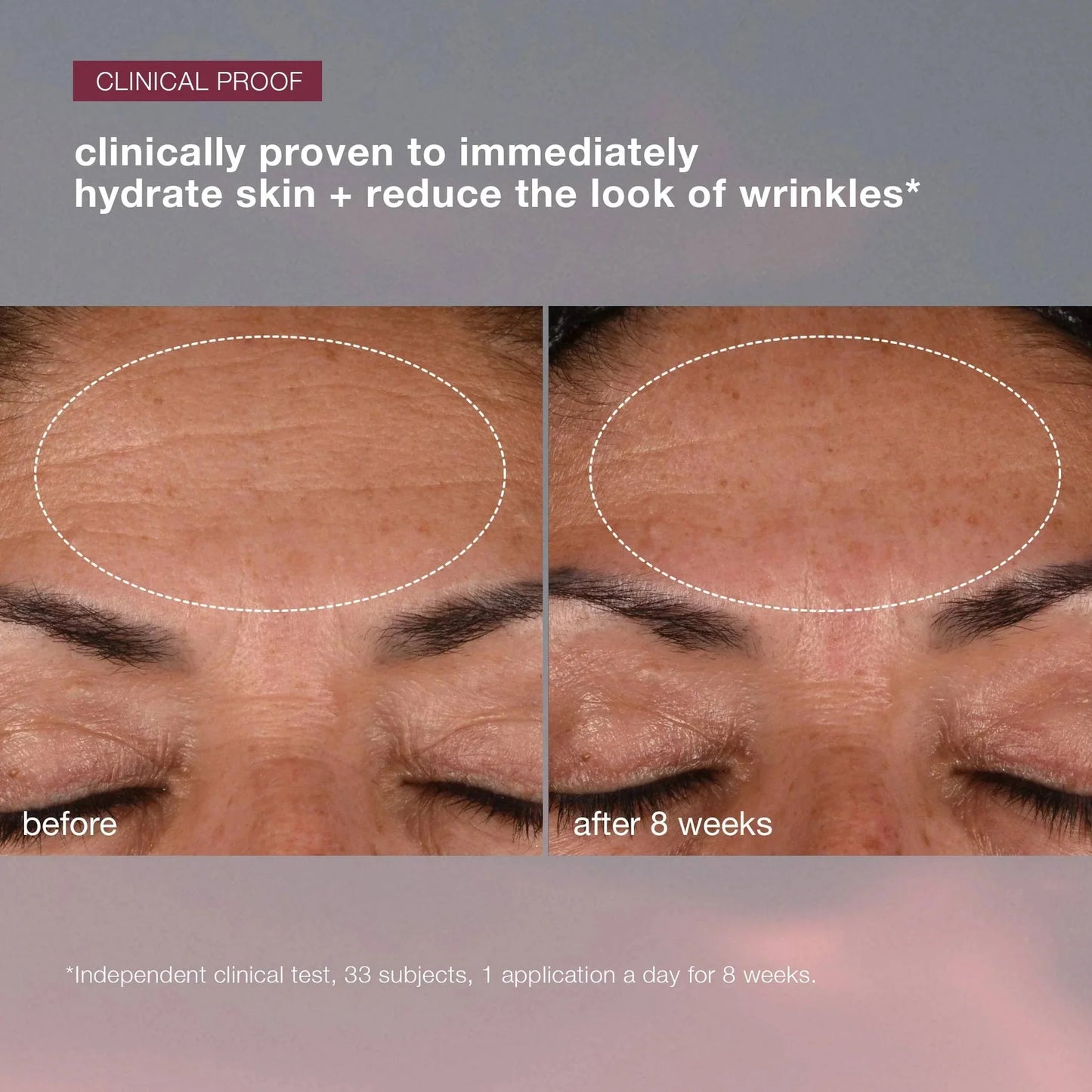 dynamic skin recovery SPF50 moisturiser