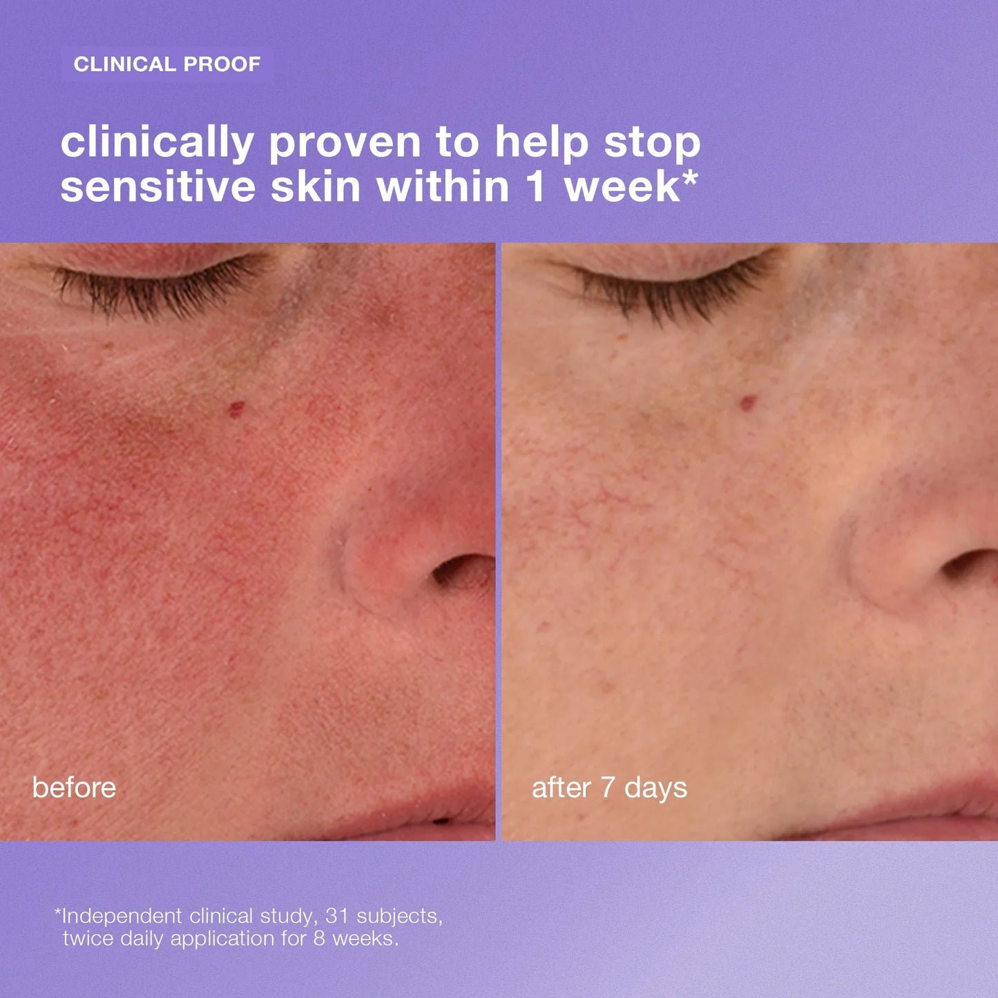 stabilizing repair cream