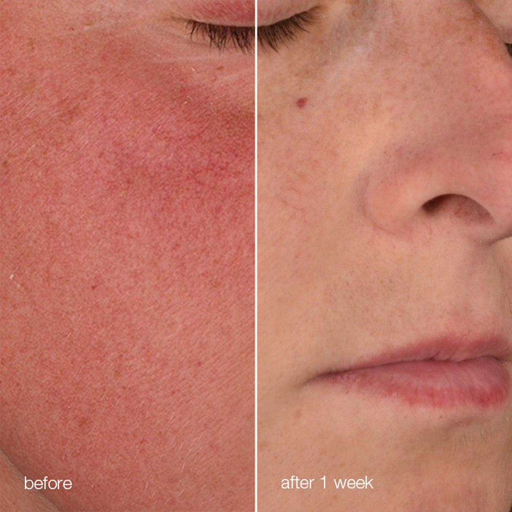 stabilizing repair cream pack